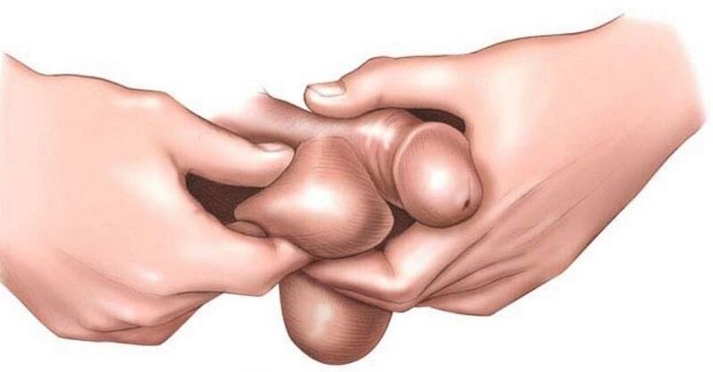 ¿Por qué los huevos se pica en los hombres